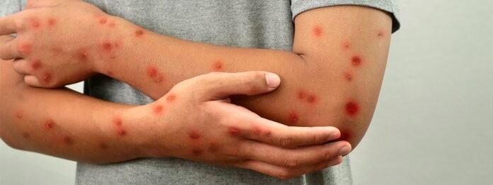 whatsapp-image-2025-05-04-at-154126