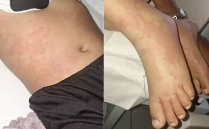 menina_contaminada_ype-qe13k3gieova